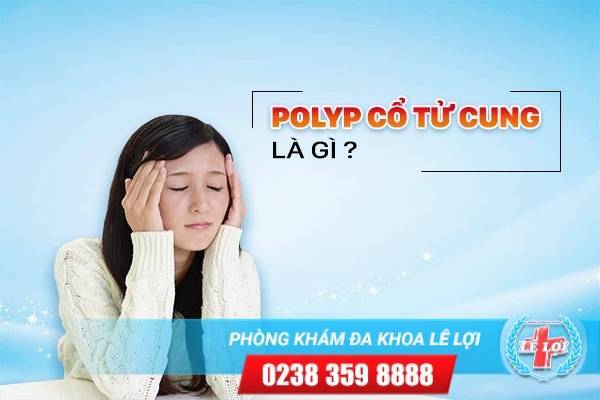 Polyp Cổ Tử Cung Là Căn Bệnh Như Thế Nào Và Những Điều Cần Chú Ý