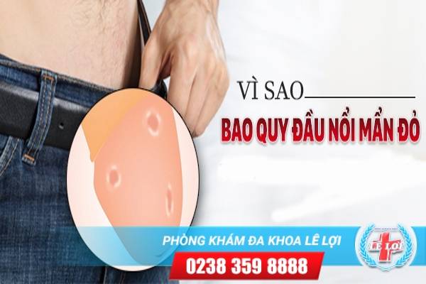 Quy đầu nổi mẫn đỏ ảnh hưởng đến sức khỏe như thế nào ?