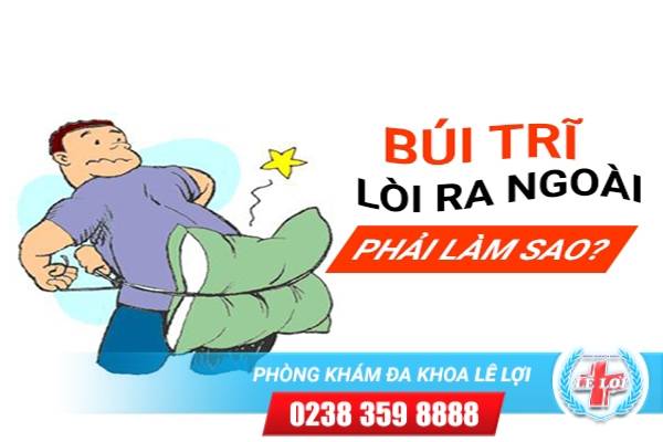 Sa Búi Trĩ, Triệu Chứng Và Phương Pháp Hỗ Trợ Điều Trị Hiệu Quả