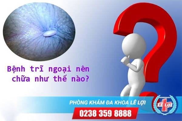 Bệnh Trĩ Ngoại – Mối Nguy Hiểm Khôn Lường Đối Với Sức Khỏe