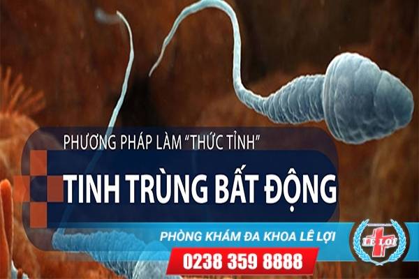 Cách Hỗ Trợ Điều Trị Tinh Trùng Bất Động Hiệu Quả