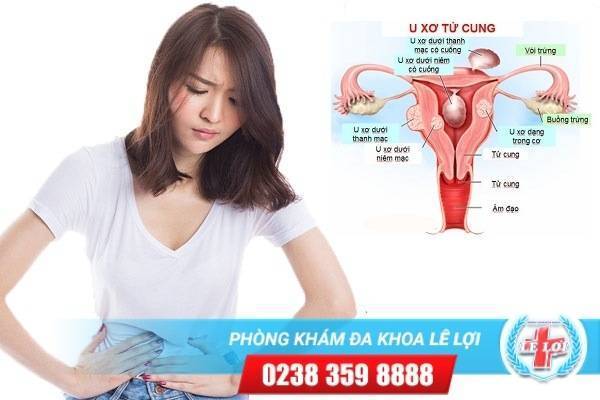 Đau bụng dưới là dấu hiệu của bệnh gì?