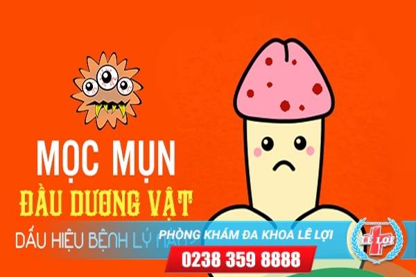 Dương vật mọc mụn có phải bị sùi mào gà không ?