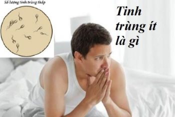 Tình trạng tinh trùng ít có chữa được không ?