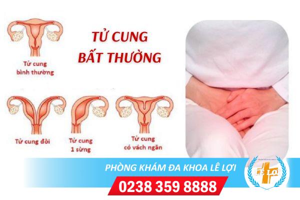 tu-cung-bat-thuong-anh-huong-den-kha-nang-sinh-san-1