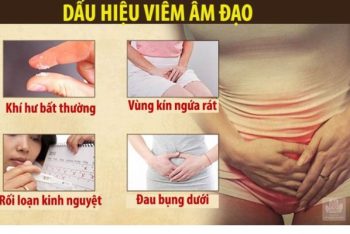 Các bệnh phụ khoa thường gặp ở nữ giới