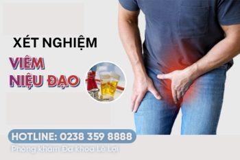 Các cách xét nghiệm chẩn đoán viêm niệu đạo cho nam giới