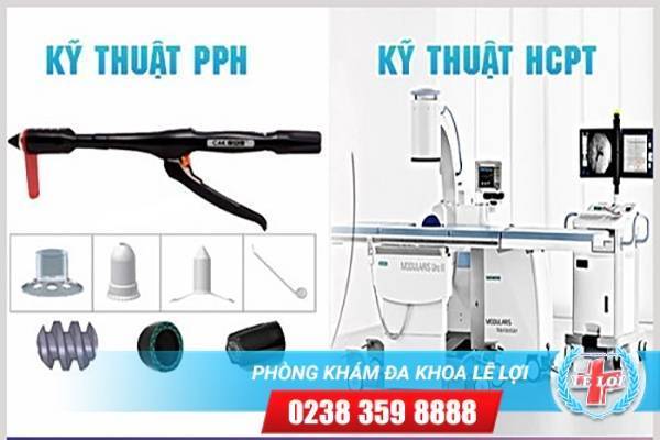 Phương pháp nào cắt búi trĩ tốt hiện nay tại Vinh ?