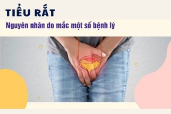 Nguyên nhân gây ra chứng tiểu rắt