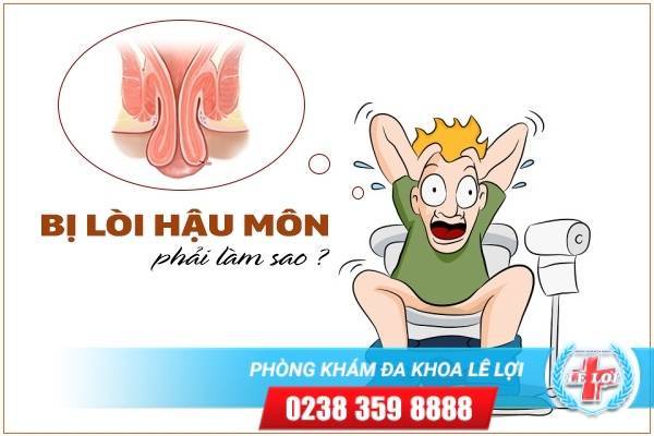 Bị lòi hậu môn phải làm sao?