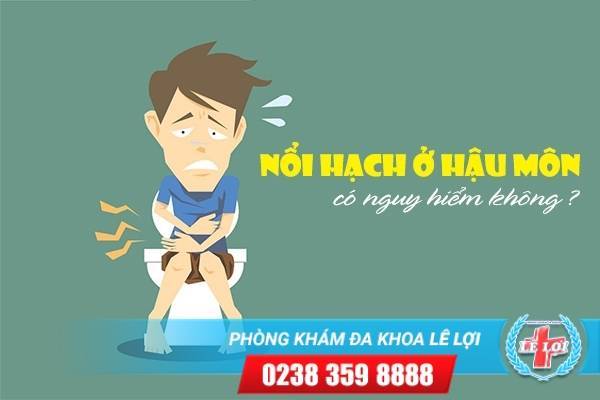 Nổi hạch ở hậu môn có nguy hiểm không?