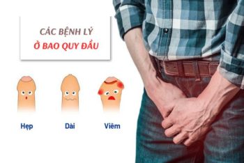 Các bệnh lý ở bao quy đầu không nên bỏ qua