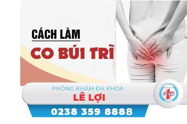 Cách làm co búi trĩ hiệu quả