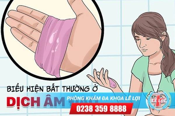 Biểu hiện bất thường ở dịch âm đạo cho biết bệnh phụ khoa gì?