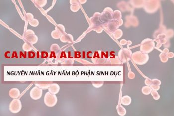 Nguyên nhân gây nấm ở bộ phận sinh dục