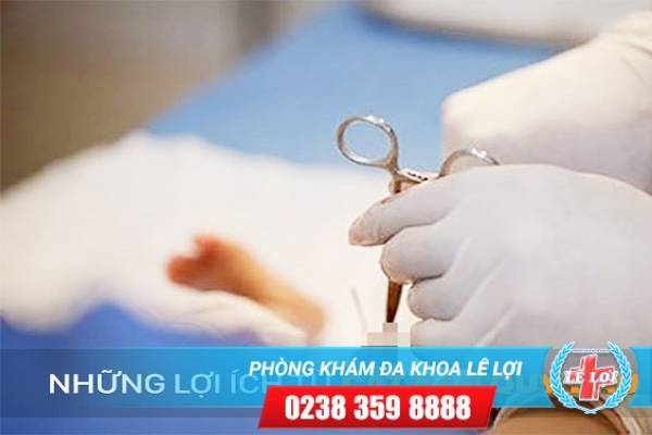 Những lợi ích từ cắt bao quy đầu nam giới nên biết