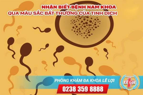 Phát hiện bệnh nam khoa qua màu sắc bất thường của tinh dịch