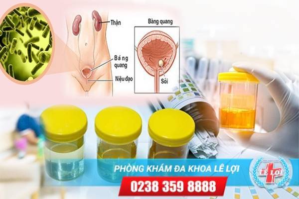 Hiện tượng són tiểu - Những cảnh báo cho nữ giới