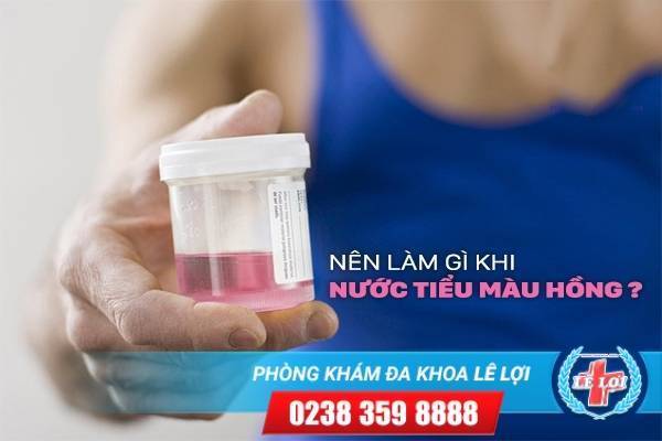 Nên làm gì khi nước tiểu màu hồng?