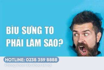 Phát hiện bìu sưng to – Đây là đều cần nên làm