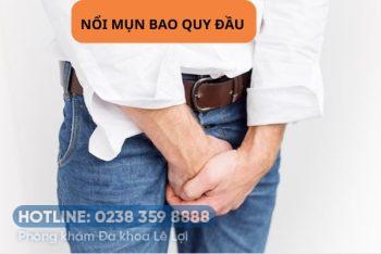 Nổi mụn ở bao quy đầu là bị bệnh gì?
