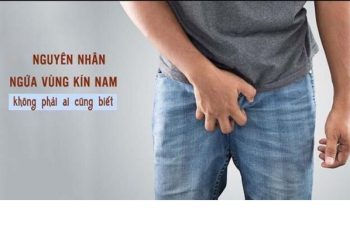 Ngứa vùng kín nam giới nguyên nhân và cách điều trị