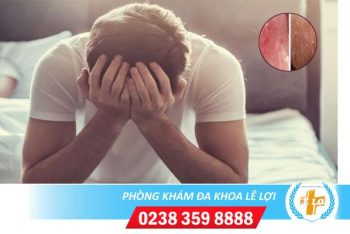 Nổi mụn ở dương vật là bị bệnh gì có nguy hiểm không?