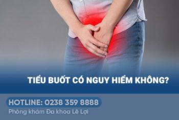 Đi tiểu buốt – dấu hiệu cảnh báo nguy hiểm