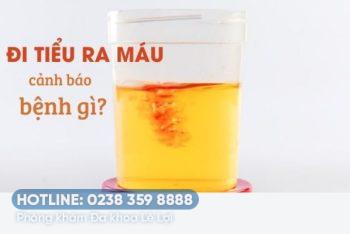 Đi tiểu ra máu là đang mắc bệnh gì?