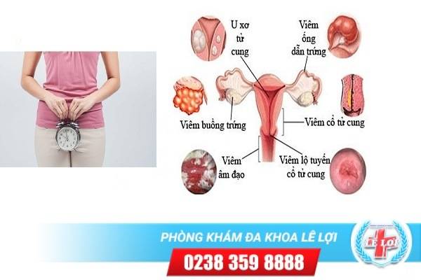 Chậm kinh là triệu chứng của bệnh gì?