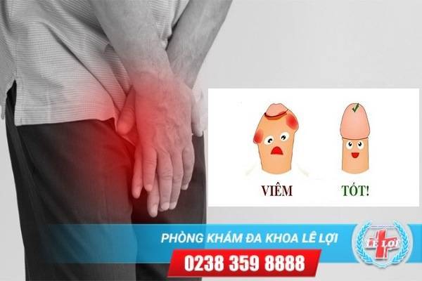 Nguyên nhân nổi mụn ở lỗ sáo và cách điều trị hiệu quả