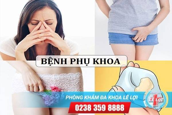 Hỗ trợ Chữa Viêm Phụ Khoa Hiệu Quả Tại Phòng Khám Phụ Khoa Lê Lợi