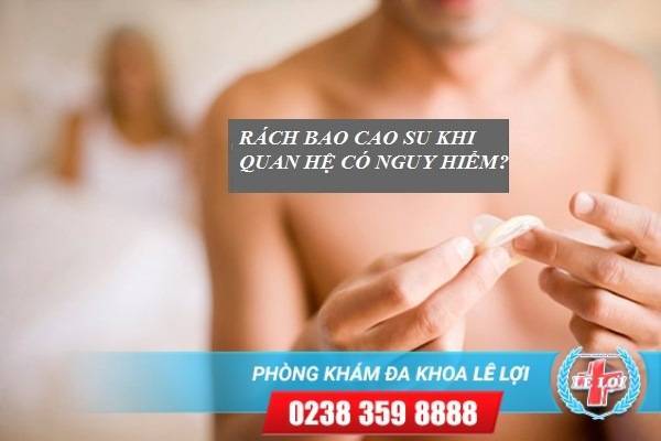 Rách bao cao su khi quan hệ có nguy hiểm không?