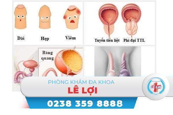 Phòng tránh các bệnh nam khoa thường gặp ở nam giới