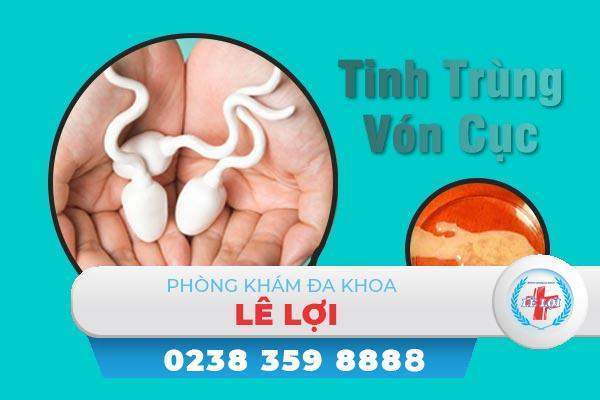 Tinh trùng vón cục ở nam giới là như thế nào ?