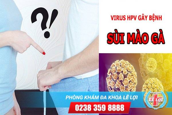 Bệnh sùi mào gà – Căn bệnh lây qua đường tình dục nguy hiểm hiện nay