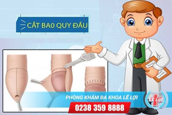 Cần cắt bao quy đầu gấp ở những trường hợp nào?