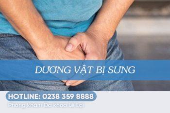 Bạn có biết bị sưng dương vật là bệnh gì và phương pháp xử lý