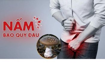 Nấm bao quy đầu có nguy hiểm không và cách xử lý hiệu quả