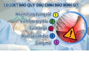 Nam giới bị lở loét bao quy đầu là bệnh gì và phải làm thế nào để chữa trị ?