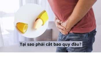 Cắt bao quy đầu là gì? Khi nào nên cắt bao quy đầu