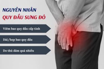 Nguyên nhân vì sao gây ra triệu chứng quy đầu bị sưng đỏ ?