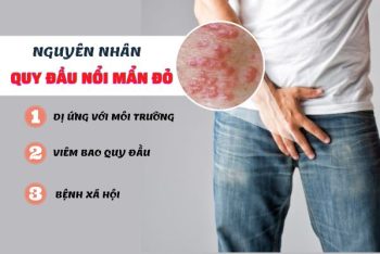 Quy đầu nổi mẩn đỏ dấu hiệu của nhiều bệnh nguy hiểm