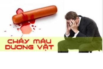 Tại sao nam giới lại bị dương vật chảy máu?