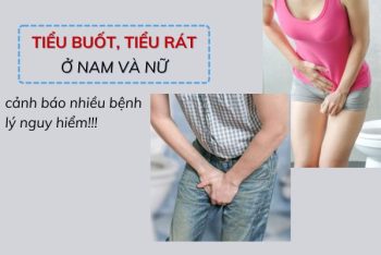 Tiểu buốt, tiểu rát là triệu chứng của các bệnh lý nguy hiểm