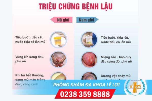 tieu-thuong-xuyen-tieu-nhieu-lan-trong-ngay-trieu-chung-khong-the-xem-thuong-1