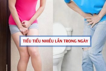 Tiểu thường xuyên – tiểu nhiều lần trong ngày triệu chứng không thể xem thường