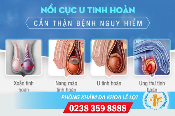 tinh-hoan-noi-cuc-la-bi-benh-gi-1