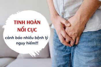 Tinh hoàn nổi cục là bị bệnh gì?