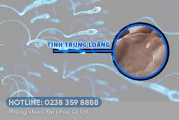 Phương pháp hỗ trợ điều trị chứng tinh trùng loãng?